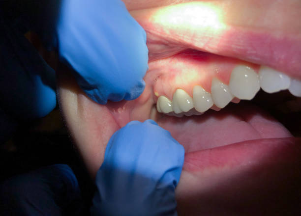 Best Emergency Denture Repair in South Hill, VA